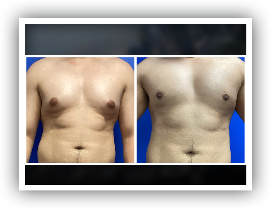 dao-chest-1
